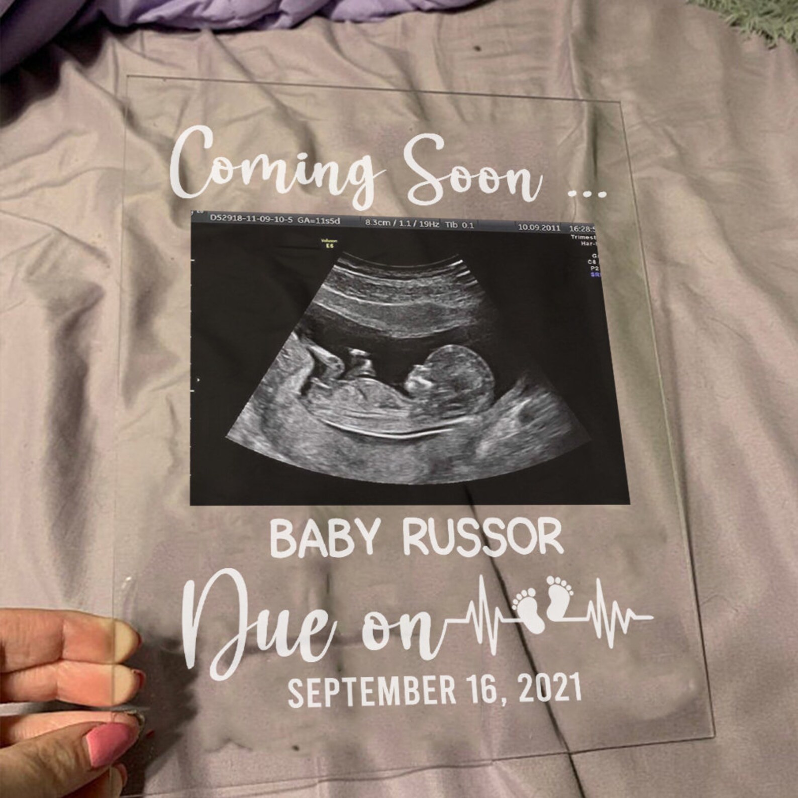 Ultrasound custom baby announcement pregnancy personalised Etsy