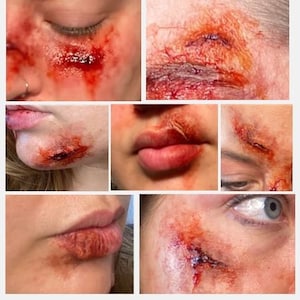 The Nicks & Cuts Set of 7 | Silicone Prosthetic | Face Injury SFX Make Up
