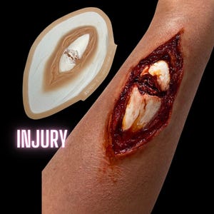 May include: A realistic fake injury prop for Halloween or special effects makeup. The prop is a large, open wound with exposed bone and blood. The prop is made of silicone and is designed to look like a real injury.