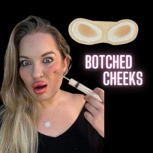 Puede incluir: Una mujer con cabello rubio y una blusa negra se muestra con una jeringa cerca de su mejilla. El texto "BOTCHED CHEEKS" se muestra en blanco. Encima del texto hay una almohadilla médica beige y blanca.