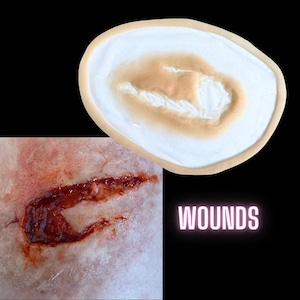 Skin Wound 5 | SFX Make Up | Silicone Prosthetic