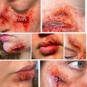 The Nicks & Cuts Set of 7 | Silicone Prosthetic | Face Injury SFX Make Up