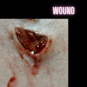 The Skin Wound 1 | SFX Make Up | Silicone Prosthetic
