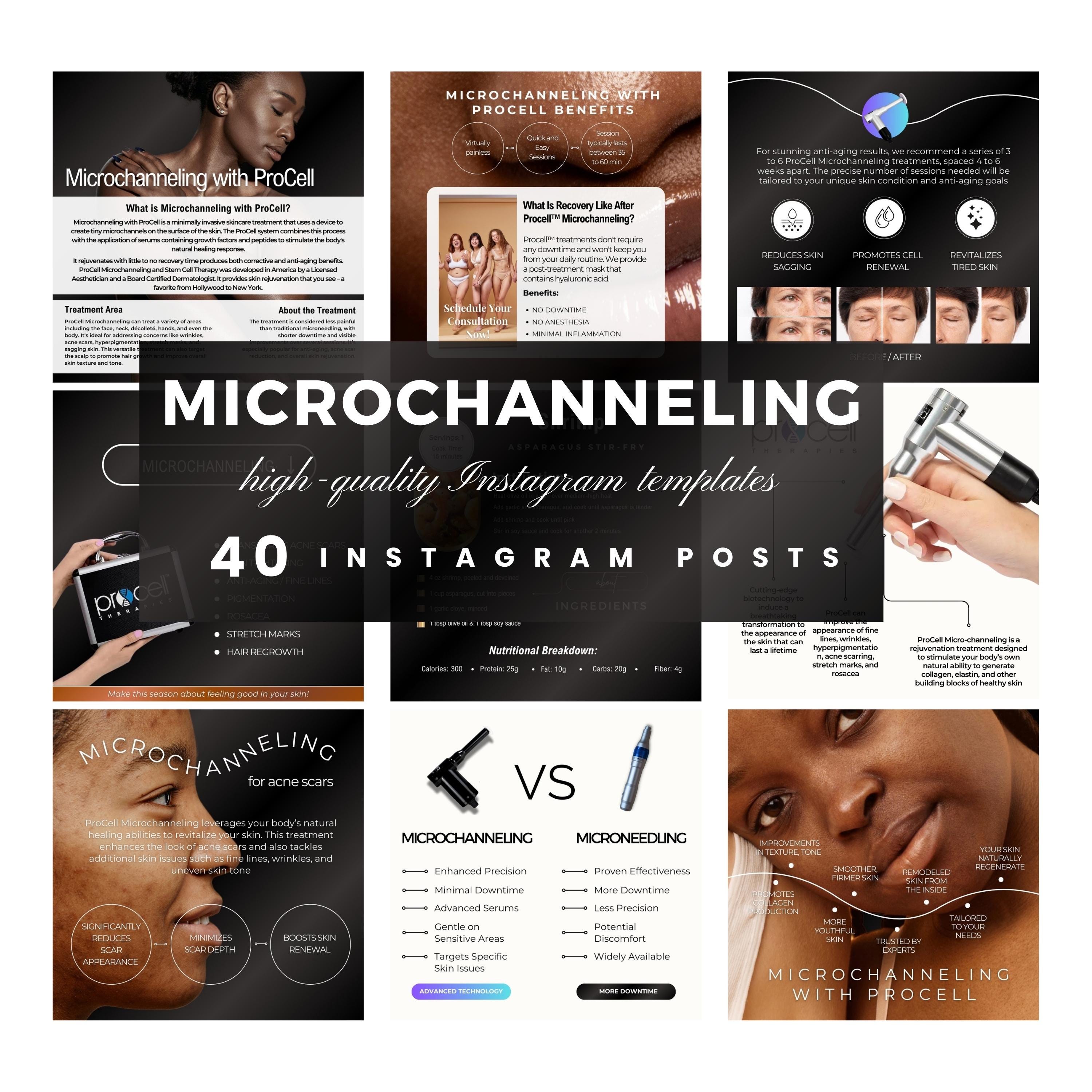 Microchanneling Posts, Microchanneling Treatment, Skin Clinic Templates, Instagram Posts, Editable Canva, Social Media Posts