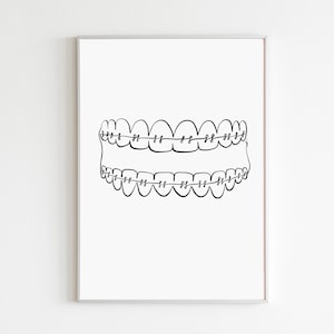May include: A black and white line drawing of a set of teeth with braces. The braces are on both the top and bottom teeth.