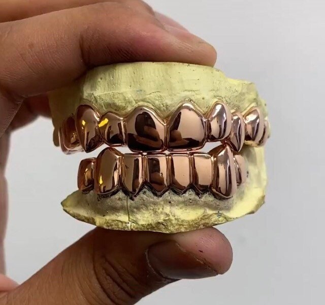 Yellow Gold Grillz Etsy