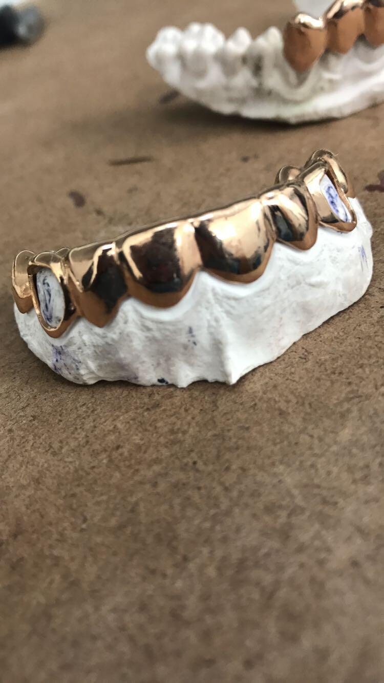Yellow Gold Grillz Etsy
