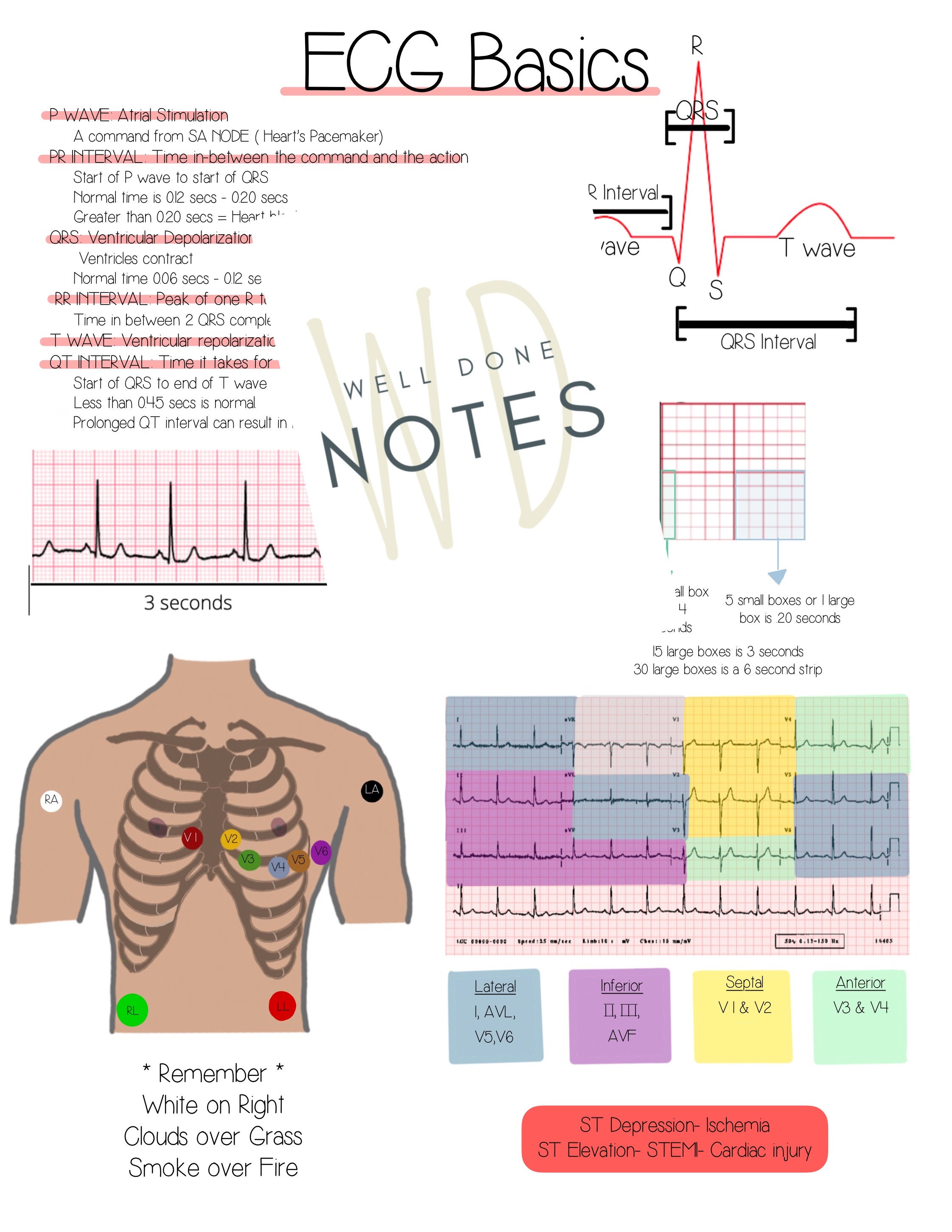 ACLS Study Guide and EKG Basics Etsy