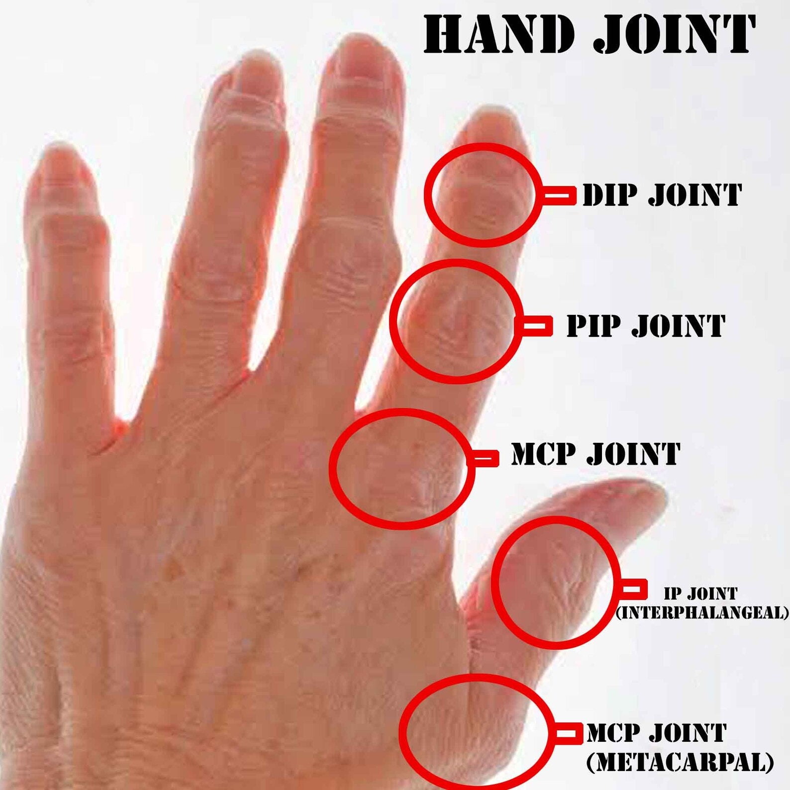 Thumb Splint 925 Silver Ring MCP Hyperextension Splint Etsy