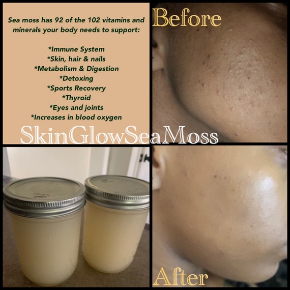 sea moss for your skin