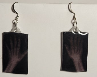 Hand X-ray earrings