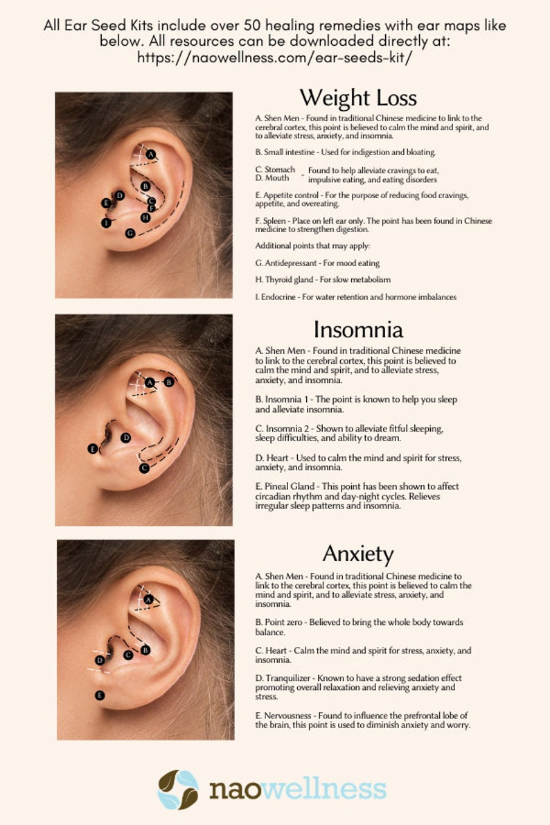 Ear Seeds - How Do They Work And Can They Help With Stress?