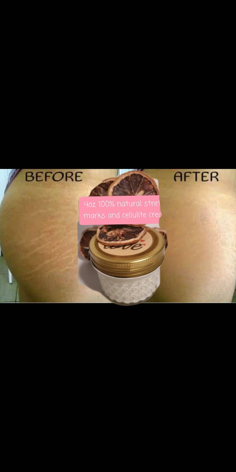 4oz 100natural products stretch marks and cellulite cream Etsy