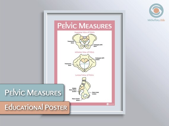 Pelvis Level Ruler Pelvic Measures Educational Poster | Etsy