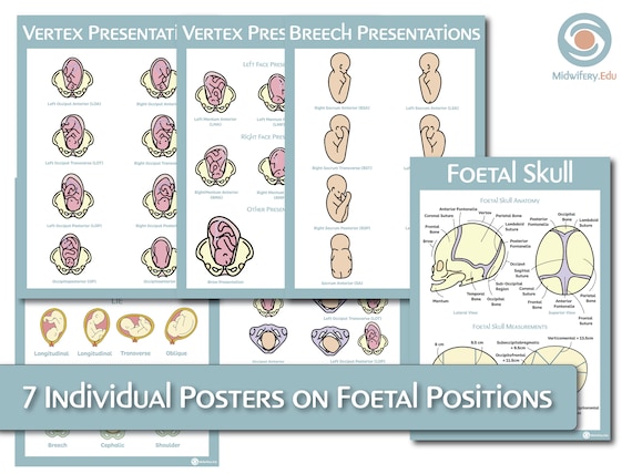 Fetal Positions Nursingnclex Pinterest Midwifery