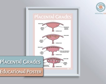 Placenta Grading Educational Poster