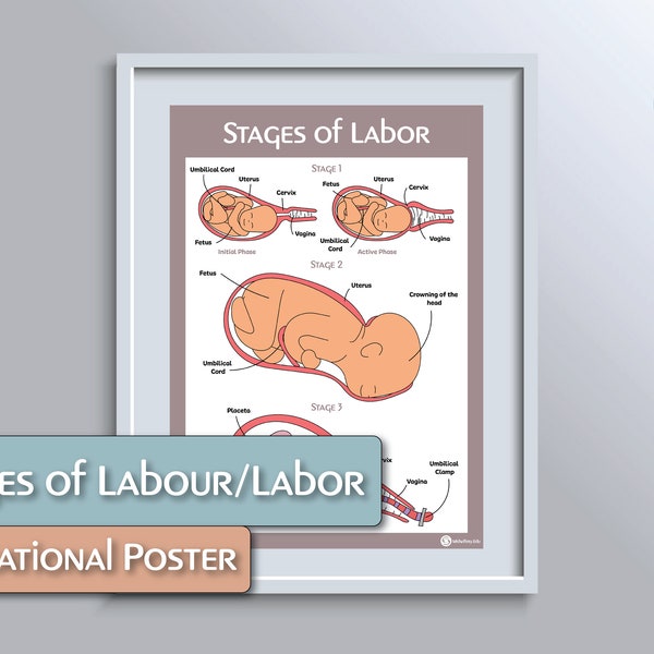 Stages of Labour/Labor Educational Poster