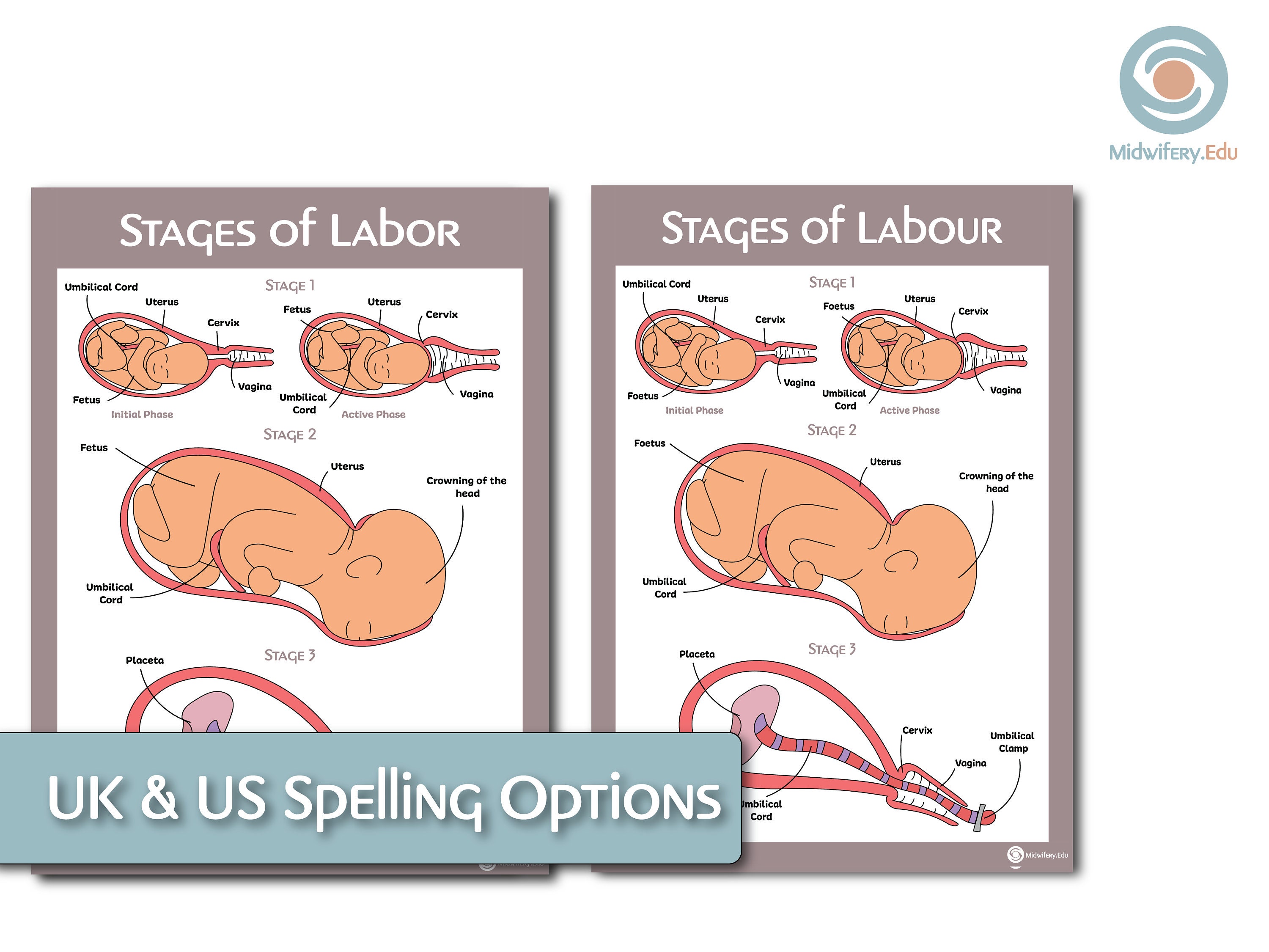 Stages of Labour/labor Educational Poster Etsy UK