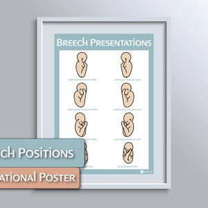 Breech Presentations Educational Poster