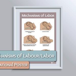 Póster educativo sobre parto/mecanismos laborales de nacimiento