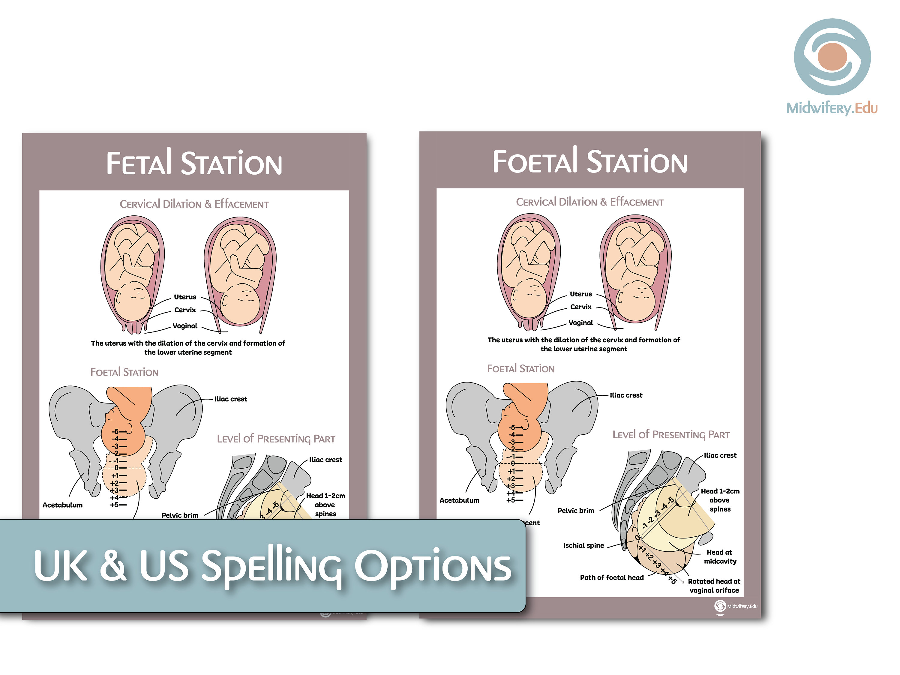 Foetal/fetal Station Educational Poster Etsy