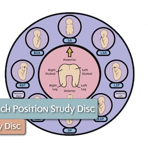 Breech Position Birth Wheel
