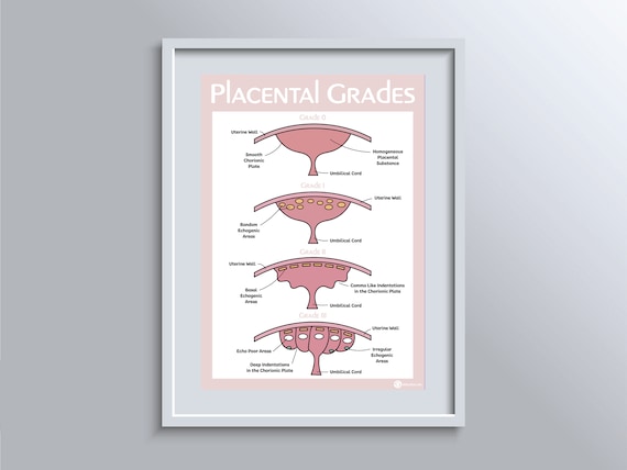 拙作「Placenta」 Placenta — Eisco Labs
