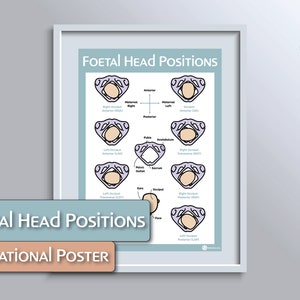 Foetal/Fetal Head Position Educational Poster