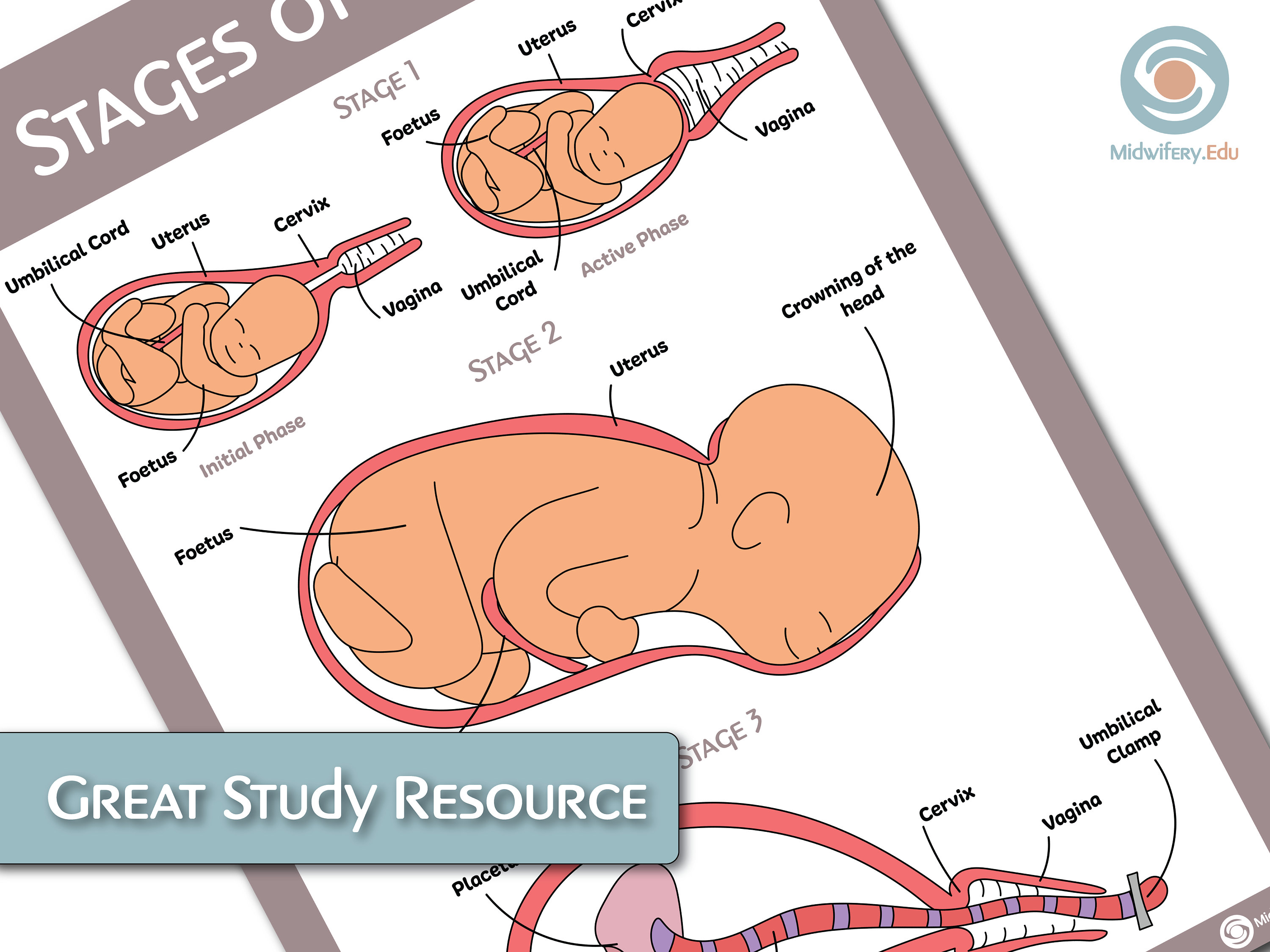 Stages of Labour/Labor Educational Poster Etsy