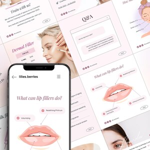 Nurse injector instagram post, Botox template, Botox and filler templates, Nurse injector templates, Medspa template, Aesthetics templates