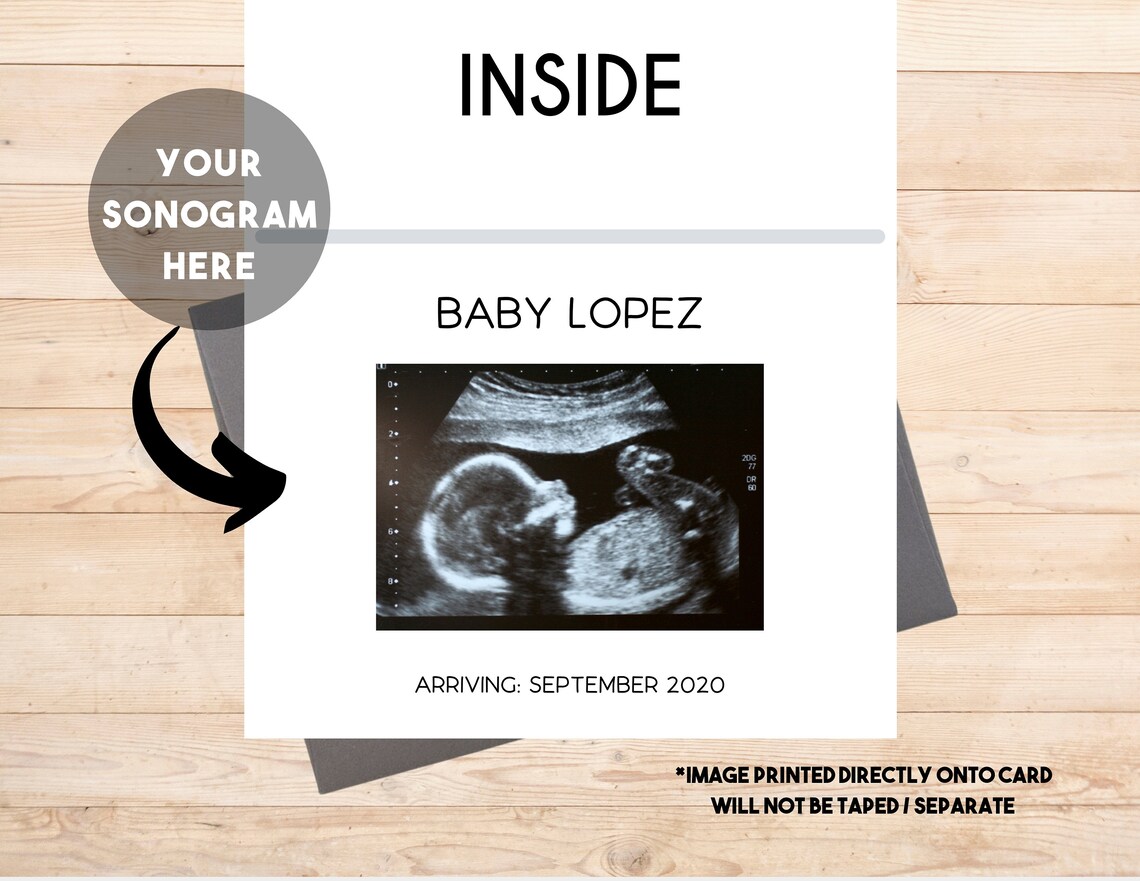 Custom Ultrasound Baby Announcement Card Sonogram Etsy