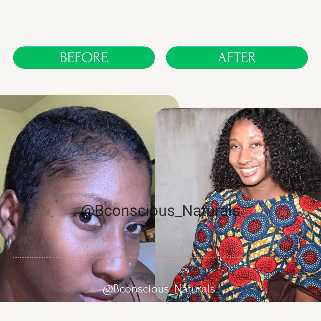 Pcos Queen Hair Loss Growth Oil,dht Blocking Non Greasy Hair Growth Oil for All Hair Types and