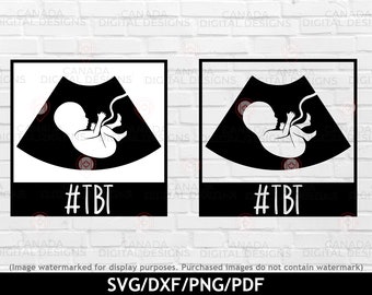 Download Ultrasound Baby Svg Etsy