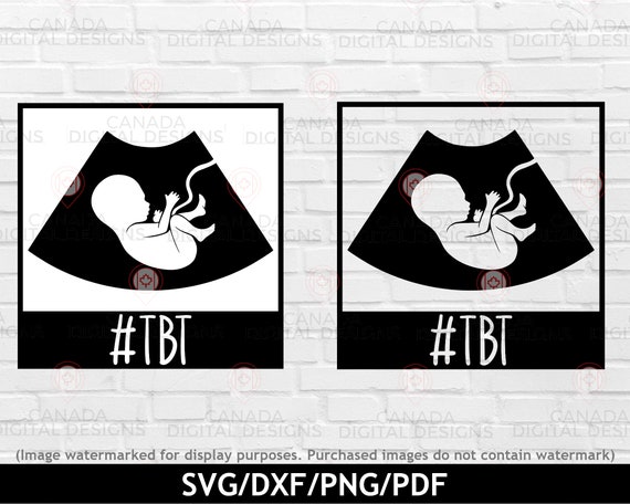 TBT Baby Ultrasound Svg Funny Baby Shirt Design Polaroid - Etsy Australia TBT Baby Ultrasound Svg Funny Baby Shirt Design Polaroid - Etsy Australia