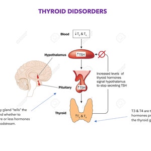 Hypothyroidism and Hyperthyroidism (Nursing School Notes)