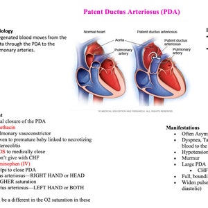 Puede incluir: Diagrama de un corazón con un conducto arterioso persistente (CAP), una condición en la que el conducto arterioso, un vaso sanguíneo que conecta la aorta y la arteria pulmonar, permanece abierto después del nacimiento. El diagrama muestra el corazón normal a la izquierda y el corazón con CAP a la derecha. El diagrama también incluye texto que describe la condición, su tratamiento y sus manifestaciones.