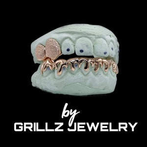 Combo grillz free top two, buy the dripping bottom grill and get two top free with diamond dust (SILVER 925 ONLY), fast process