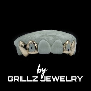 Trendy custom grillz with open face and middle two skipped with small fangs / canines added, done fast, express delivered by Grillz jewelry