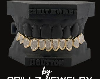 Personalized Diamond Dust Grillz: Yellow Gold Rap Jewelry, Free Mold Kit