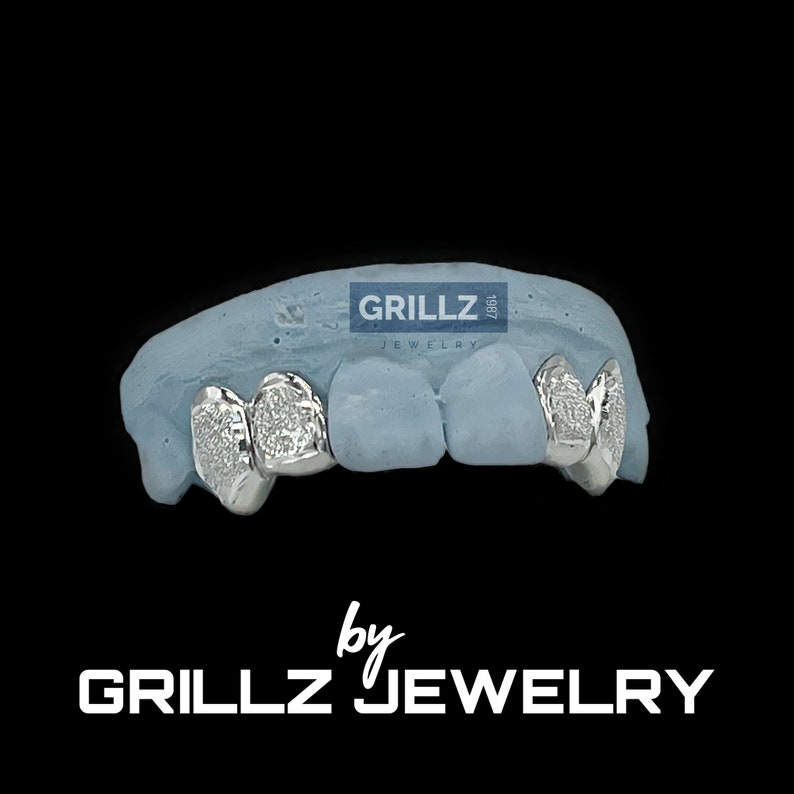 High-quality grillz, custom grillzjewelry, and gold grillz for men, designed to impress