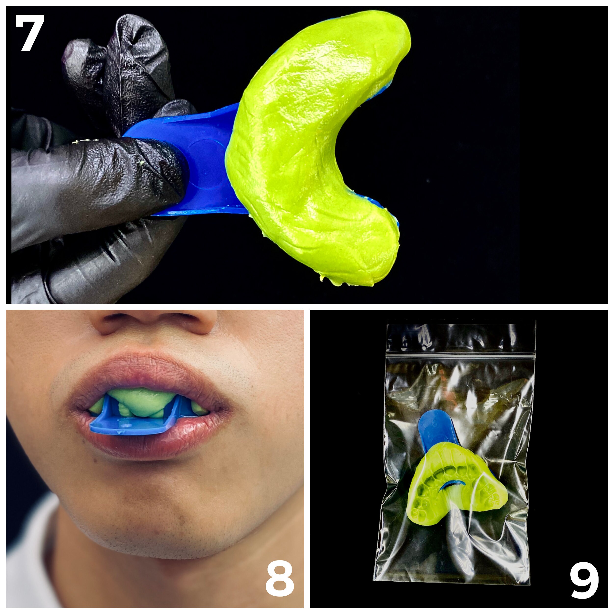 Grillz Mold Kits / Dental Mold Kits for Custom Fit Grillz With Etsy