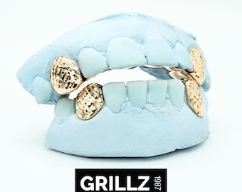 Custom 10K Gold Grillz: Diamond Dust Fangs with Backbar