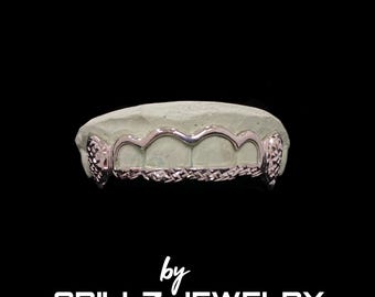 Custom Open Face Grillz: Sterling Silver, Gold, or Rose Gold