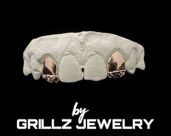Diamond Cut Fangs Grillz with Back Bar: Custom 10k/14k Gold