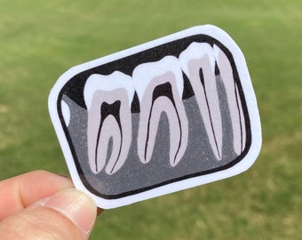 Dental X-Ray Teeth Sticker for Dental Hygienist, Dental Assistant, RDH, Dental Student Gift, Hygienist Gift, Assistant Gift, Dental Stickers
