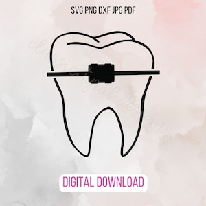 Arquivos SVG Ortho Tooth Dental, download digital para Cricut ou Silhouette (inclui .jpg .svg .png .pdf) ortodontista, aparelho ortodôntico, suporte ortodôntico