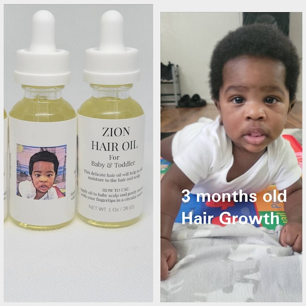 Baby and Toddler Hair Oil| Growth OilPreservative free|Paraben free|Sulfate free|