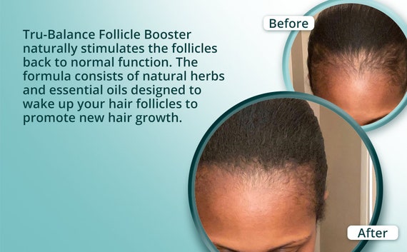 Follicle Booster Hair Growth Balm: Hair Regrowth Repair Bald - Etsy Follicle Booster Hair Growth Balm: Hair Regrowth Repair Bald - Etsy