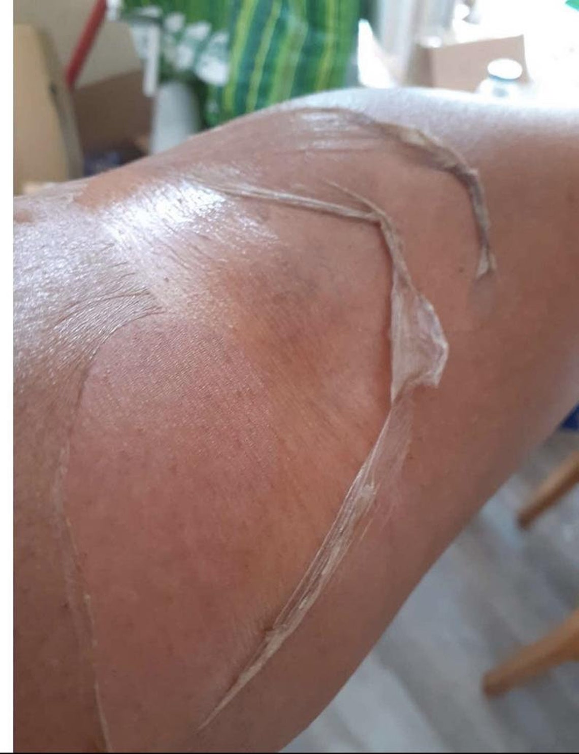 Powerful Yellow Peeling oil Etsy