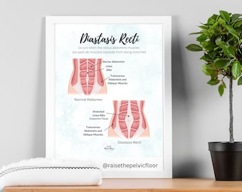 Diastasis Recti Pelvic Floor Art Poster | Postpartum, Pregnancy, Pelvic Floor Physical Therapist | Pelvic floor anatomy health